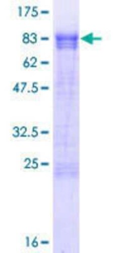 Novus Biologicals&trade;&nbsp;Recombinant Human PPHLN1 GST (N-Term) Protein