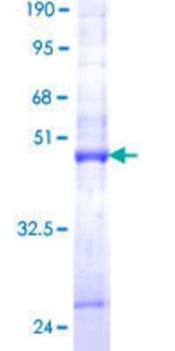 Novus Biologicals Recombinant Human MTP18 GST (N-Term) Protein 10 &mu;g | Buy Online | Novus Biologicals&trade; | Fisher Scientific