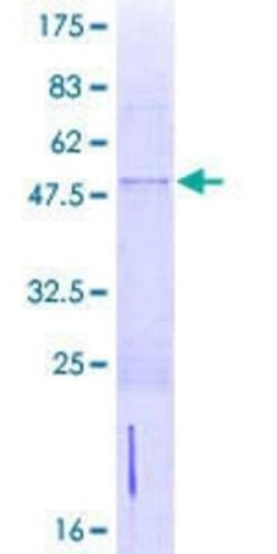 Novus Biologicals Recombinant Human Zinc finger protein 581 GST (N-Term) Protein 2 &mu;g | Buy Online | Novus Biologicals&trade; | Fisher Scientific