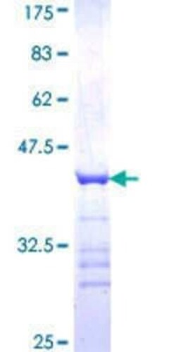 Novus Biologicals Recombinant Human ARMCX3 GST (N-Term) Protein 10 &mu;g | Buy Online | Novus Biologicals&trade; | Fisher Scientific