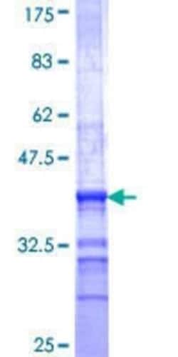 Novus Biologicals Recombinant Human MIR16 GST (N-Term) Protein 25 &mu;g | Buy Online | Novus Biologicals&trade; | Fisher Scientific