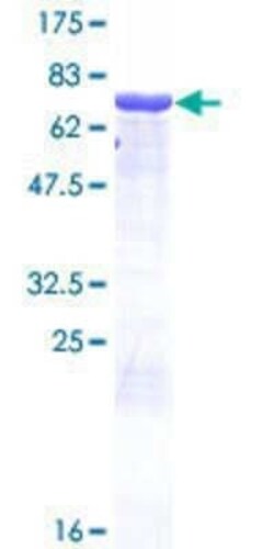 Novus Biologicals Recombinant Human Antizyme inhibitor 1 GST (N-Term) Protein 10 &mu;g | Buy Online | Novus Biologicals&trade; | Fisher Scientific