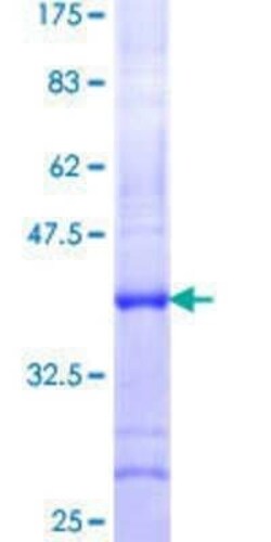 Novus Biologicals Recombinant Human MED15 GST (N-Term) Protein 10 &mu;g | Buy Online | Novus Biologicals&trade; | Fisher Scientific