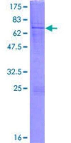 Novus Biologicals Recombinant Human lipoyltransferase 1 GST (N-Term) Protein 2 &mu;g | Buy Online | Novus Biologicals&trade; | Fisher Scientific