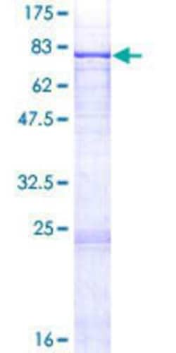 Novus Biologicals Recombinant Human PIGT GST (N-Term) Protein 2 &mu;g | Buy Online | Novus Biologicals&trade; | Fisher Scientific