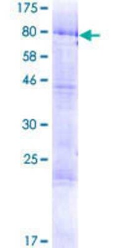 Novus Biologicals Recombinant Human CGI-09 GST (N-Term) Protein 2 &mu;g | Buy Online | Novus Biologicals&trade; | Fisher Scientific