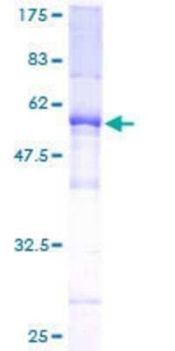 Novus Biologicals Recombinant Human TAF9b GST (N-Term) Protein 25 &mu;g | Buy Online | Novus Biologicals&trade; | Fisher Scientific