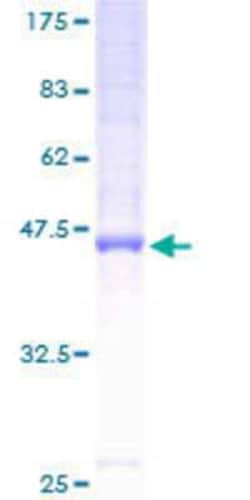 Novus Biologicals Recombinant Human HMP19 GST (N-Term) Protein 10 &mu;g | Buy Online | Novus Biologicals&trade; | Fisher Scientific