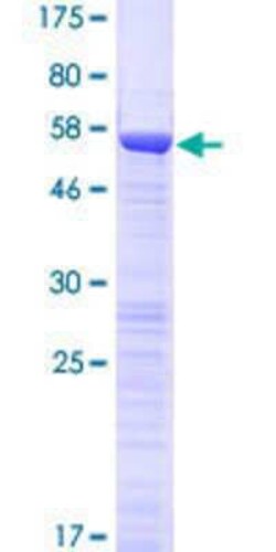 Novus Biologicals Recombinant Human OTUD6B GST (N-Term) Protein 10 &mu;g | Buy Online | Novus Biologicals&trade; | Fisher Scientific