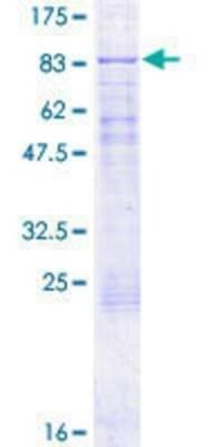 Novus Biologicals Recombinant Human CDK5RAP1 GST (N-Term) Protein 2 &mu;g | Buy Online | Novus Biologicals&trade; | Fisher Scientific