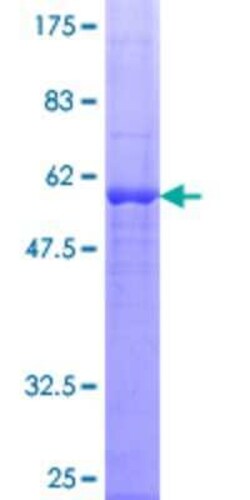 Novus Biologicals Recombinant Human Dexras1 GST (N-Term) Protein 25 &mu;g | Buy Online | Novus Biologicals&trade; | Fisher Scientific
