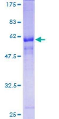 Novus Biologicals Recombinant Human STYXL1 GST (N-Term) Protein 10 &mu;g | Buy Online | Novus Biologicals&trade; | Fisher Scientific