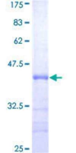 Novus Biologicals Recombinant Human PSF2 GST (N-Term) Protein 10 &mu;g | Buy Online | Novus Biologicals&trade; | Fisher Scientific