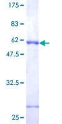Novus Biologicals Recombinant Human FKBP7 GST (N-Term) Protein 25 &mu;g | Buy Online | Novus Biologicals&trade; | Fisher Scientific