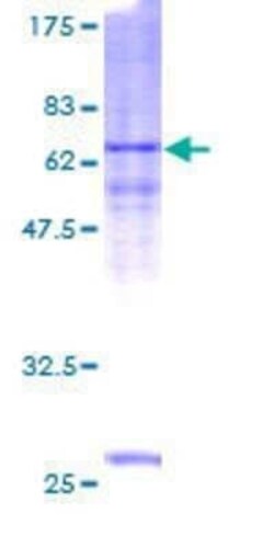 Novus Biologicals Recombinant Human ASB1 GST (N-Term) Protein 2 &mu;g | Buy Online | Novus Biologicals&trade; | Fisher Scientific