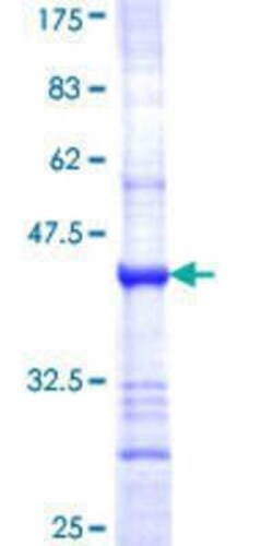 Novus Biologicals Recombinant Human ASB4 GST (N-Term) Protein 10 &mu;g | Buy Online | Novus Biologicals&trade; | Fisher Scientific