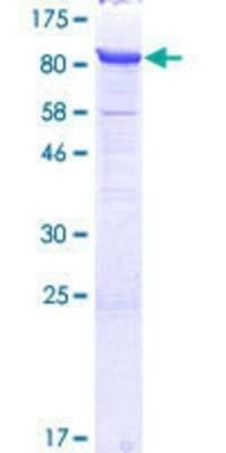 Novus Biologicals Recombinant Human NUB1/NYREN18 GST (N-Term) Protein 10 &mu;g | Buy Online | Novus Biologicals&trade; | Fisher Scientific