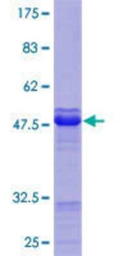 Novus Biologicals Recombinant Human NUB1/NYREN18 GST (N-Term) Protein 10 &mu;g | Buy Online | Novus Biologicals&trade; | Fisher Scientific