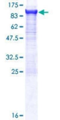 Novus Biologicals Recombinant Human CPSF73 GST (N-Term) Protein 10 &mu;g | Buy Online | Novus Biologicals&trade; | Fisher Scientific