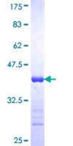 Novus Biologicals Recombinant Human CPSF73 GST (N-Term) Protein 25 &mu;g | Buy Online | Novus Biologicals&trade; | Fisher Scientific