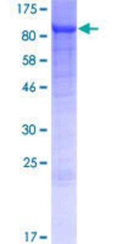 Novus Biologicals Recombinant Human ACSL5 GST (N-Term) Protein 25 &mu;g | Buy Online | Novus Biologicals&trade; | Fisher Scientific