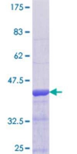 Novus Biologicals Recombinant Human GPRC5B GST (N-Term) Protein 10 &mu;g | Buy Online | Novus Biologicals&trade; | Fisher Scientific