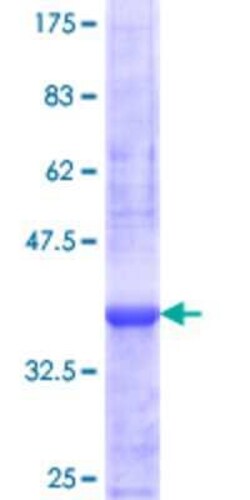 Novus Biologicals Recombinant Human ZNF44 GST (N-Term) Protein 25 &mu;g | Buy Online | Novus Biologicals&trade; | Fisher Scientific