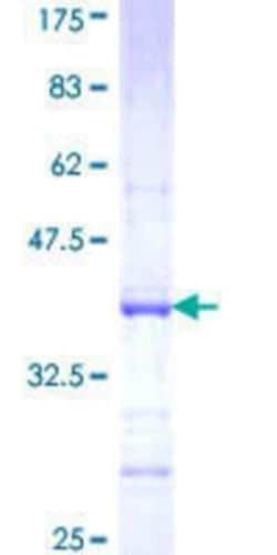 Novus Biologicals Recombinant Human FBXO40 GST (N-Term) Protein 2 &mu;g | Buy Online | Novus Biologicals&trade; | Fisher Scientific