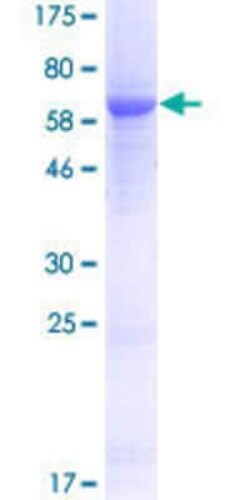 Novus Biologicals Recombinant Human beta ureidopropionase GST (N-Term) Protein 25 &mu;g | Buy Online | Novus Biologicals&trade; | Fisher Scientific