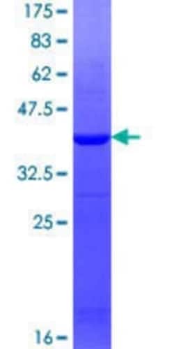 Novus Biologicals Recombinant Human beta ureidopropionase GST (N-Term) Protein 10 &mu;g | Buy Online | Novus Biologicals&trade; | Fisher Scientific