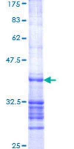Novus Biologicals Recombinant Human RAGEF2 GST (N-Term) Protein 25 &mu;g | Buy Online | Novus Biologicals&trade; | Fisher Scientific