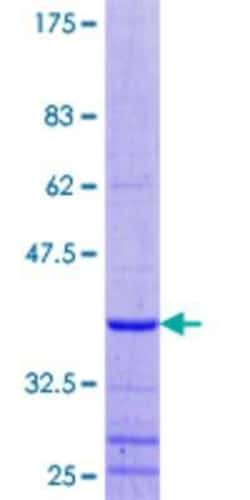 Novus Biologicals Recombinant Human CROP GST (N-Term) Protein 10 &mu;g | Buy Online | Novus Biologicals&trade; | Fisher Scientific