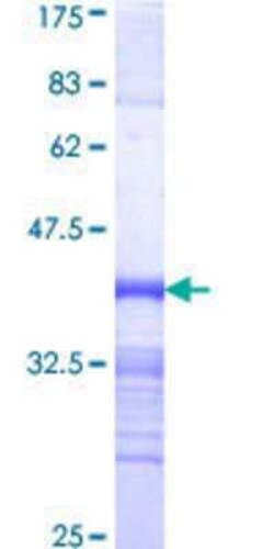 Novus Biologicals Recombinant Human CrkRS GST (N-Term) Protein 25 &mu;g | Buy Online | Novus Biologicals&trade; | Fisher Scientific