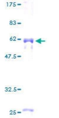 Novus Biologicals Recombinant Human Myozenin 2 GST (N-Term) Protein 2 &mu;g | Buy Online | Novus Biologicals&trade; | Fisher Scientific