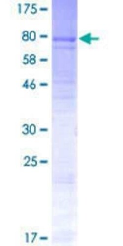 Novus Biologicals Recombinant Human ACCN5 GST (N-Term) Protein 2 &mu;g | Buy Online | Novus Biologicals&trade; | Fisher Scientific
