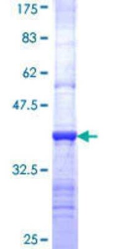 Novus Biologicals Recombinant Human COQ3 GST (N-Term) Protein 10 &mu;g | Buy Online | Novus Biologicals&trade; | Fisher Scientific