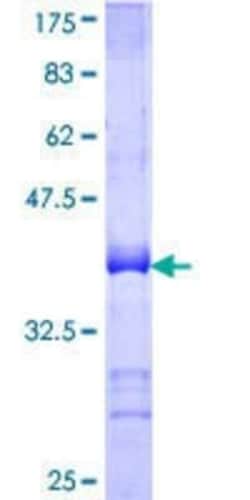 Novus Biologicals Recombinant Human Ctip1 GST (N-Term) Protein 10 &mu;g | Buy Online | Novus Biologicals&trade; | Fisher Scientific