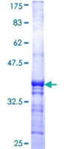 Novus Biologicals Recombinant Human BTBD1 GST (N-Term) Protein 25 &mu;g | Buy Online | Novus Biologicals&trade; | Fisher Scientific