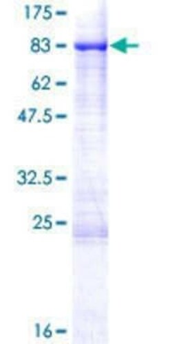 Novus Biologicals Recombinant Human SHC3 GST (N-Term) Protein 10 &mu;g | Buy Online | Novus Biologicals&trade; | Fisher Scientific