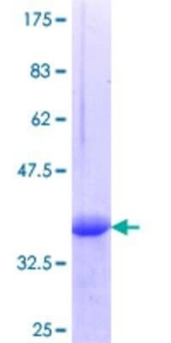 Novus Biologicals Recombinant Human SHC3 GST (N-Term) Protein 25 &mu;g | Buy Online | Novus Biologicals&trade; | Fisher Scientific