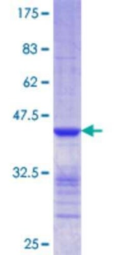 Novus Biologicals Recombinant Human CLIC5 GST (N-Term) Protein 10 &mu;g | Buy Online | Novus Biologicals&trade; | Fisher Scientific