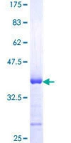 Novus Biologicals Recombinant Human STX18 GST (N-Term) Protein 10 &mu;g | Buy Online | Novus Biologicals&trade; | Fisher Scientific