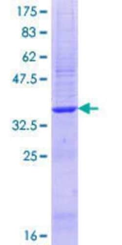 Novus Biologicals Recombinant Human BCMO1 GST (N-Term) Protein 25 &mu;g | Buy Online | Novus Biologicals&trade; | Fisher Scientific
