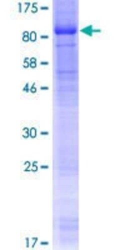 Novus Biologicals Recombinant Human PRKAG3 GST (N-Term) Protein 10 &mu;g | Buy Online | Novus Biologicals&trade; | Fisher Scientific