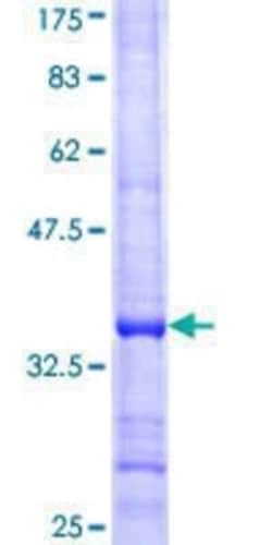 Novus Biologicals Recombinant Human TRIM34 GST (N-Term) Protein 10 &mu;g | Buy Online | Novus Biologicals&trade; | Fisher Scientific