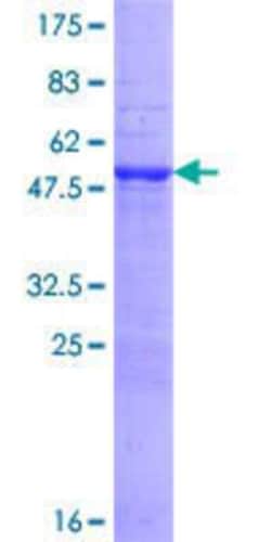 Novus Biologicals Recombinant Human MYO3A GST (N-Term) Protein 25 &mu;g | Buy Online | Novus Biologicals&trade; | Fisher Scientific