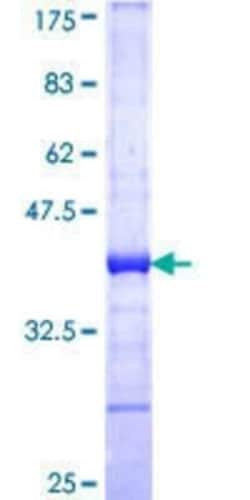 Novus Biologicals Recombinant Human MYO3A GST (N-Term) Protein 25 &mu;g | Buy Online | Novus Biologicals&trade; | Fisher Scientific