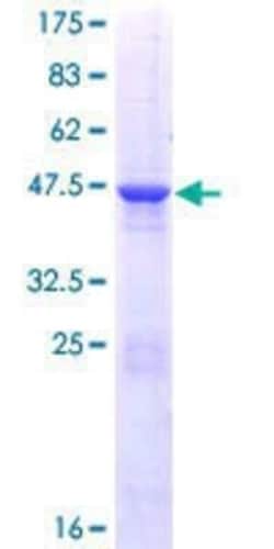 Novus Biologicals Recombinant Human RAB4B GST (N-Term) Protein 10 &mu;g | Buy Online | Novus Biologicals&trade; | Fisher Scientific