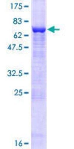 Novus Biologicals Recombinant Human PELO GST (N-Term) Protein 25 &mu;g | Buy Online | Novus Biologicals&trade; | Fisher Scientific