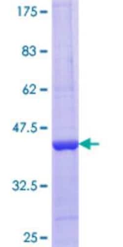 Novus Biologicals Recombinant Human PELO GST (N-Term) Protein 10 &mu;g | Buy Online | Novus Biologicals&trade; | Fisher Scientific